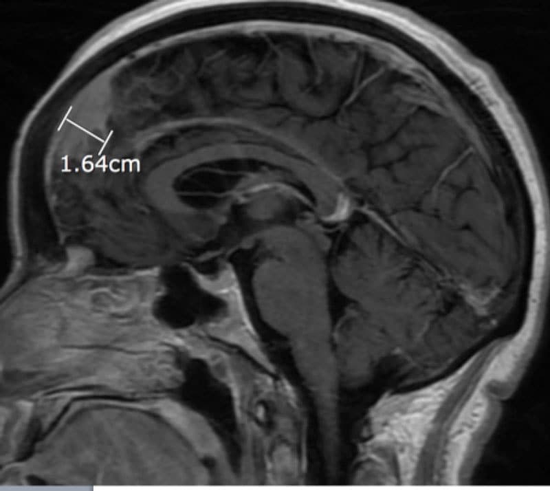 Magnetic Resonance Imaging (MRI) - New Jersey Brain and Spine